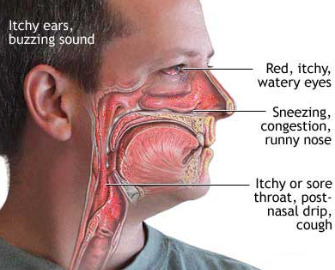 chlorine allergy rash