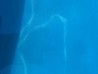 Gel Coat Problems S In A Fibergl Pool Gel Coat Problems S In A Fibergl Pool